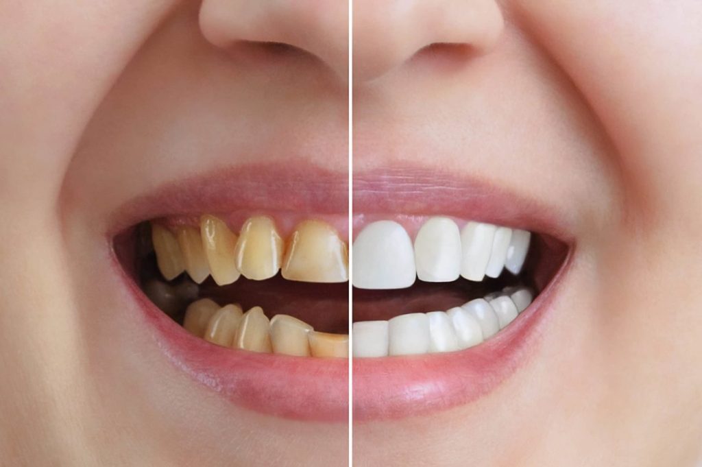 dental